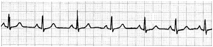 normalECG.jpg